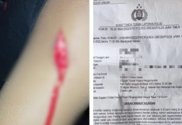 Hendak Pulang Usai Nongkrong, Pemuda Berkaos Logo Perguruan Pencak Silat Di Keroyok Dan Kepalanya Di Hantam Paving Oleh Sekelompok OTK